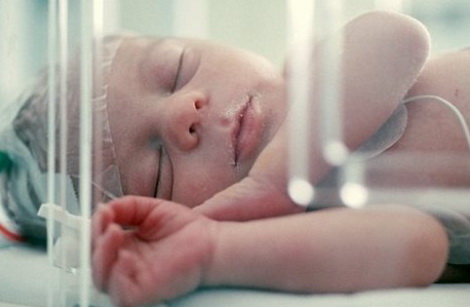 гипоксия мозга новорожденного